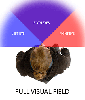 HEMI-VS-NORMAL-1 top view illustration of a person with the visual field divided into three sections: left eye (blue), right eye (red), and both eyes (purple) in the center