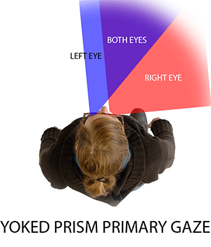 YOKED-ANIMATION top view illustration showing shifted visual fields due to yoked prisms, with altered angles for left eye (blue), right eye (red), and both eyes (purple) in the center