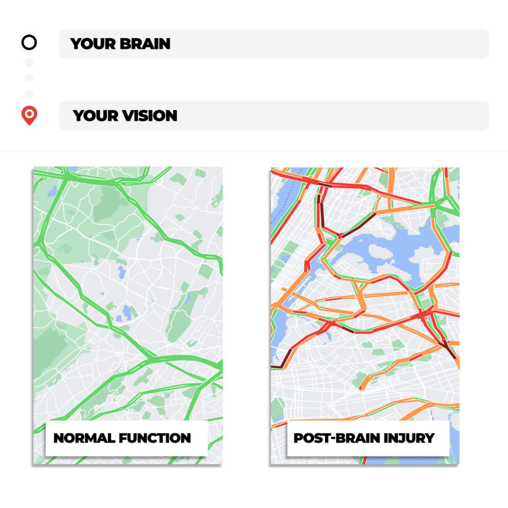 chadwick-map Comparison graphic showing maps with labeled 'Normal Function' and 'Post-Brain Injury,' with the normal map displaying clear green routes and the post-brain injury map showing congestion in red and orange lines.