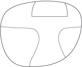 ft occupational Chadwick's Freeform progressive with standard flat-top bifocal