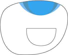 ftroundoccup Chadwick's Standard Flat-top with free-form round add (any size)