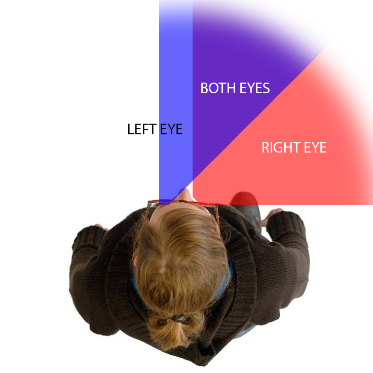 hemianopic-vision Visual field diagram showing hemianopic vision