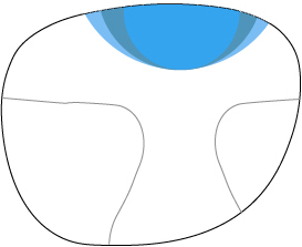 occupational PAL2 Chadwick's Standard Progressive with free-form round add (any size)