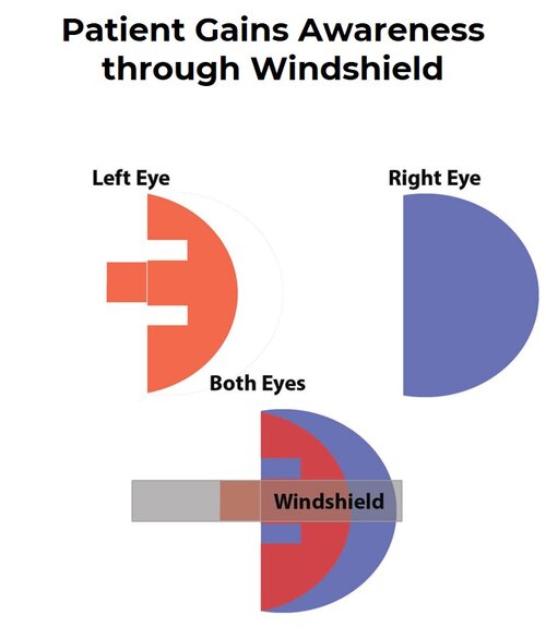 patient-gains-improved-spatial-awareness-through-peli-lens-windshield Patient Gains Improved Spatial Awareness Through Peli lens Windshield
