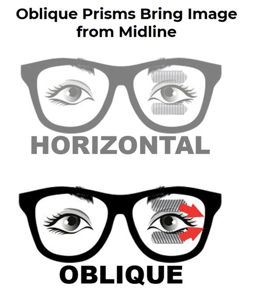 peli lens oblique prisms bring image from midline peli lens oblique prisms bring image from midline