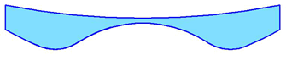 shape5 Shape #5: Biconcave Blended Myodisc Used when the RX exceeds machine limitations on Shape 4. A concave curve is cut into the front of the lens to make a lens with more power.